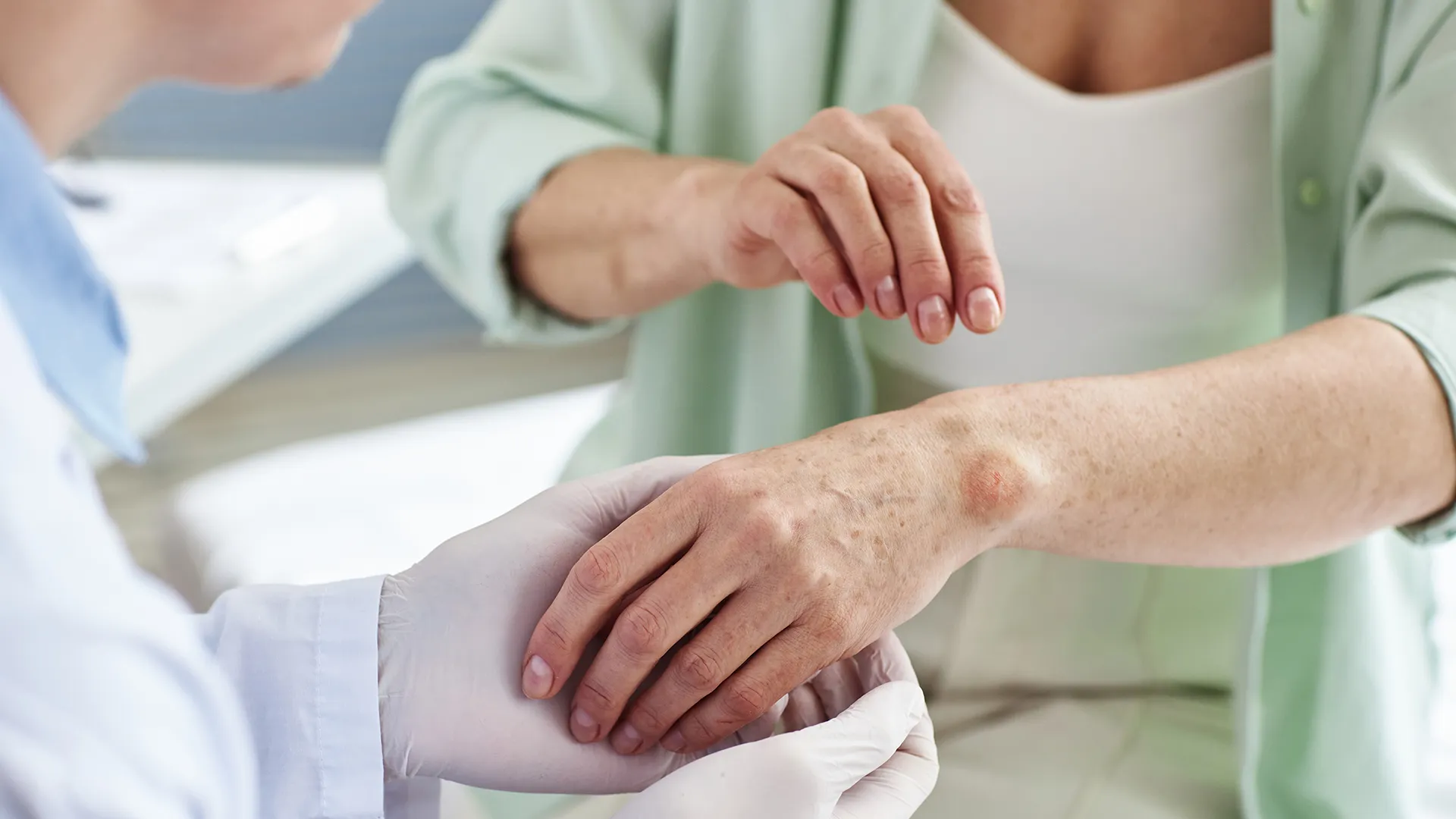 Systemic Lupus Erythematosus